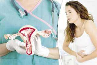 الصحة: 80 % من السيدات يصبن بالفيروس المسبب لسرطان عنق الرحم