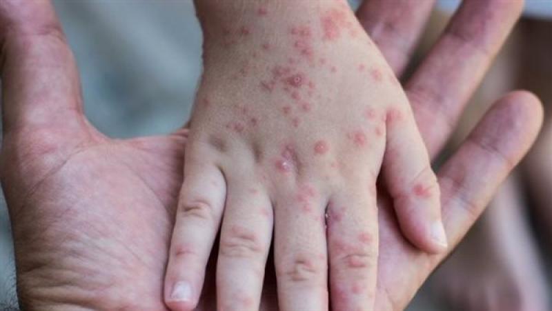 بوابة المصريين