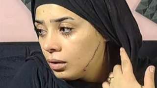 حبس المتهمة بتشويه وجه عروس مصر القديمة لمدة سنتين