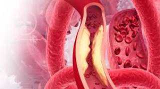 كوب واحد يوميًا من هذه المشروبات يخفض ضغط الدم ويوسع الشرايين