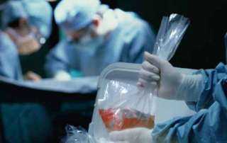 بعد جدل «بنك الأنسجة».. كيف نظم القانون المصري التبرع بالأعضاء؟